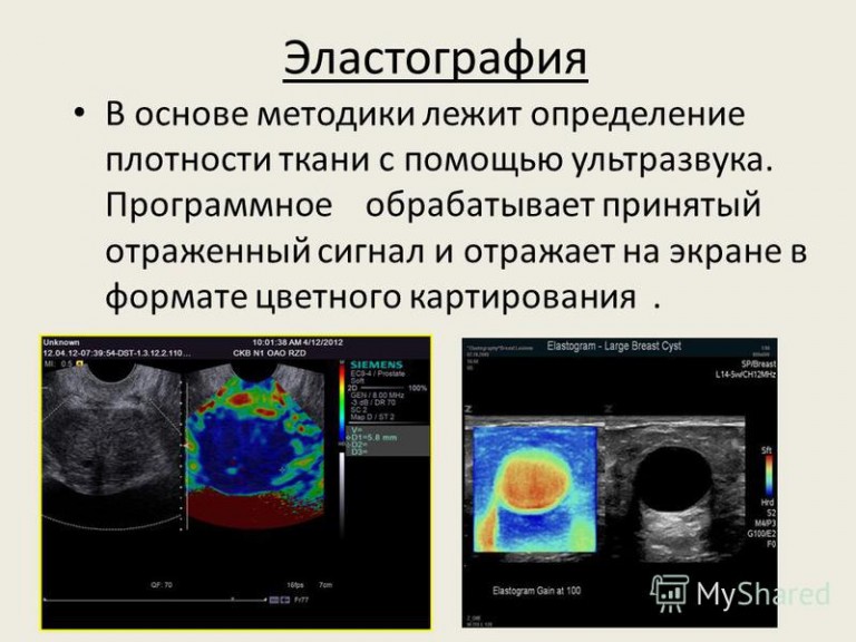 Ультразвуковая компрессионная эластография. Что такое эластография щитовидной. Соноэластография ультразвуковая эластография. Компрессионная эластография молочных желез. Что такое эластография щитовидной.